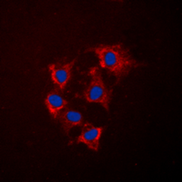 Anti-COL4A5 antibody used in Immunocytochemistry/ Immunofluorescence (ICC/IF). GTX56030