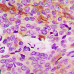 Anti-COL4A5 antibody used in IHC (Paraffin sections) (IHC-P). GTX56030