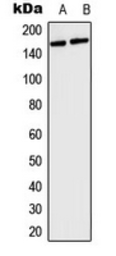Anti-COL4A5 antibody used in Western Blot (WB). GTX56030