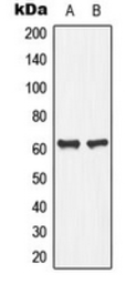 Anti-PLA2G4C antibody used in Western Blot (WB). GTX56033