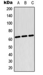 Anti-TESK2 antibody used in Western Blot (WB). GTX56036