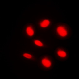 Anti-ARID1B antibody used in Immunocytochemistry/ Immunofluorescence (ICC/IF). GTX56037