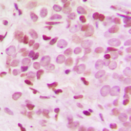 Anti-ARID1B antibody used in IHC (Paraffin sections) (IHC-P). GTX56037