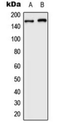Anti-ARID1B antibody used in Western Blot (WB). GTX56037