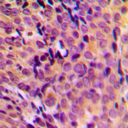 Anti-MRPL17 antibody used in IHC (Paraffin sections) (IHC-P). GTX56039