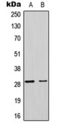 Anti-MRPL17 antibody used in Western Blot (WB). GTX56039