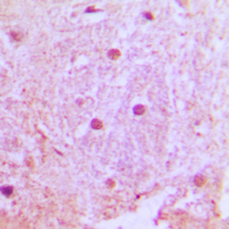 Anti-UBTD1 antibody used in IHC (Paraffin sections) (IHC-P). GTX56040
