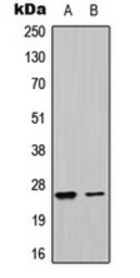 Anti-UBTD1 antibody used in Western Blot (WB). GTX56040