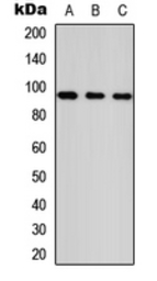 Anti-ANKRD20A1 antibody used in Western Blot (WB). GTX56043