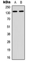 Anti-ARHGAP20 antibody used in Western Blot (WB). GTX56045