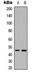 Anti-B4GALT6 antibody used in Western Blot (WB). GTX56046