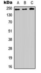 Anti-HEATR1 antibody used in Western Blot (WB). GTX56047