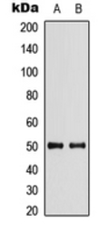 Anti-SLC29A2 antibody used in Western Blot (WB). GTX56052