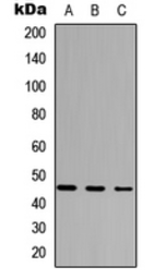 Anti-FOXD4L5 antibody used in Western Blot (WB). GTX56055
