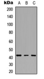 Anti-IDH3B antibody used in Western Blot (WB). GTX56056