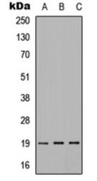 Anti-IMMP1L antibody used in Western Blot (WB). GTX56057