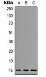 Anti-MCFD2 antibody used in Western Blot (WB). GTX56060
