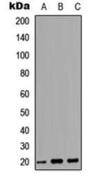 Anti-MARCKSL1 antibody used in Western Blot (WB). GTX56062