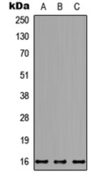 Anti-NDUFB7 antibody used in Western Blot (WB). GTX56063