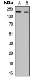 Anti-NUP210L antibody used in Western Blot (WB). GTX56066