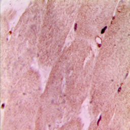 Anti-RPL3L antibody used in IHC (Paraffin sections) (IHC-P). GTX56071