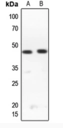 Anti-RPL3L antibody used in Western Blot (WB). GTX56071