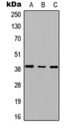 Anti-RTDR1 antibody used in Western Blot (WB). GTX56072