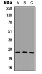 Anti-SCNM1 antibody used in Western Blot (WB). GTX56073
