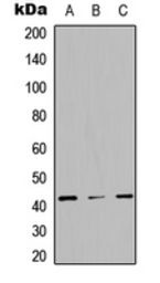 Anti-STAC3 antibody used in Western Blot (WB). GTX56074