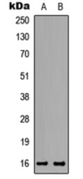 Anti-TNP2 antibody used in Western Blot (WB). GTX56077