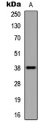 Anti-UBE2U antibody used in Western Blot (WB). GTX56079