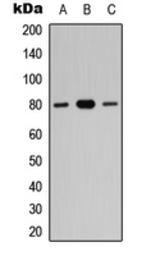 Anti-ZNF441 antibody used in Western Blot (WB). GTX56080