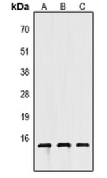 Anti-Apolipoprotein CIV antibody used in Western Blot (WB). GTX56082