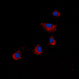 Anti-ARRDC4 antibody used in Immunocytochemistry/ Immunofluorescence (ICC/IF). GTX56083