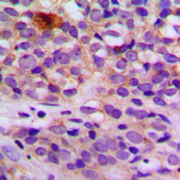 Anti-ARRDC4 antibody used in IHC (Paraffin sections) (IHC-P). GTX56083