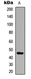 Anti-ARRDC4 antibody used in Western Blot (WB). GTX56083