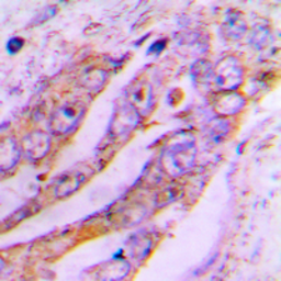Anti-ATP5J2 antibody used in IHC (Paraffin sections) (IHC-P). GTX56084