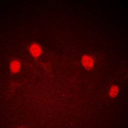 Anti-CDCA7 antibody used in Immunocytochemistry/ Immunofluorescence (ICC/IF). GTX56087