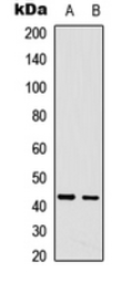 Anti-CDCA7 antibody used in Western Blot (WB). GTX56087