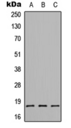Anti-CMTM1 antibody used in Western Blot (WB). GTX56089