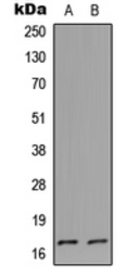 Anti-CSTL1 antibody used in Western Blot (WB). GTX56094