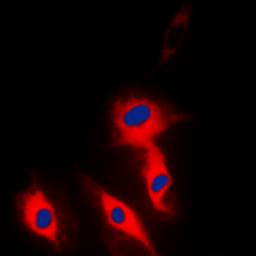 Anti-Ephrin A5 antibody used in Immunocytochemistry/ Immunofluorescence (ICC/IF). GTX56095