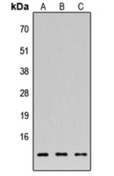 Anti-APR2 antibody used in Western Blot (WB). GTX56097