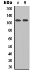 Anti-GRID2 antibody used in Western Blot (WB). GTX56101