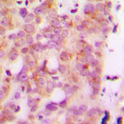 Anti-HLA-H antibody used in IHC (Paraffin sections) (IHC-P). GTX56102