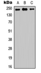 Anti-MED12 antibody used in Western Blot (WB). GTX56106