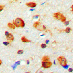 Anti-MYO1D antibody used in IHC (Paraffin sections) (IHC-P). GTX56107