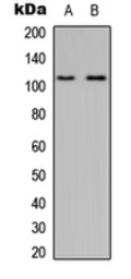 Anti-MYO1D antibody used in Western Blot (WB). GTX56107