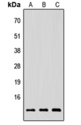 Anti-NRG4 antibody used in Western Blot (WB). GTX56111