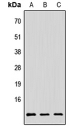 Anti-PAGE3 antibody used in Western Blot (WB). GTX56112